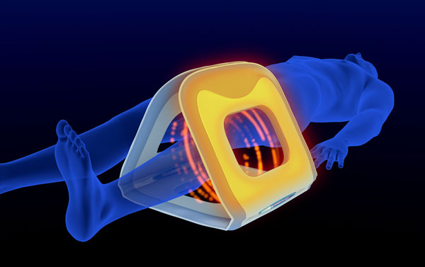 Magnetfeldtherapie ist heute ein fester Bestandteil der unterstützenden Therapie von Schmerzen