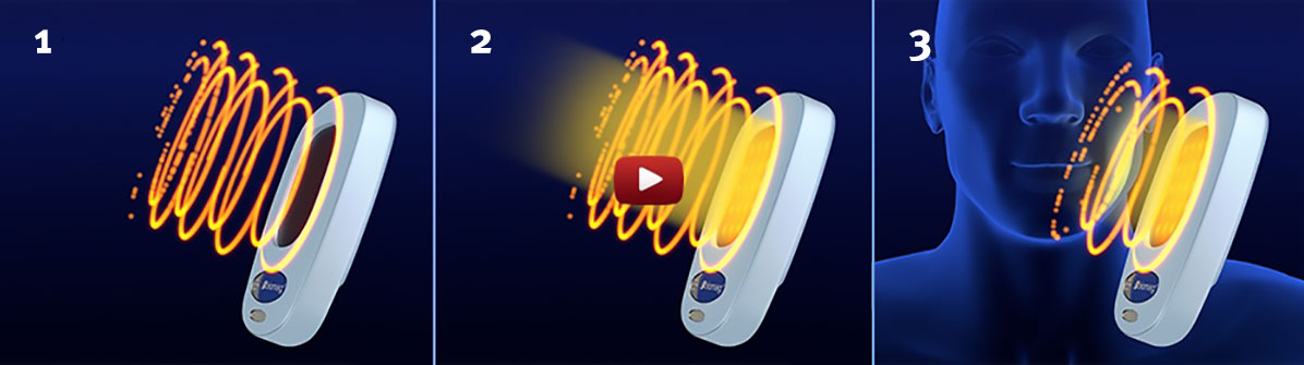 Video für die Verwendung eines Kopfapplikators